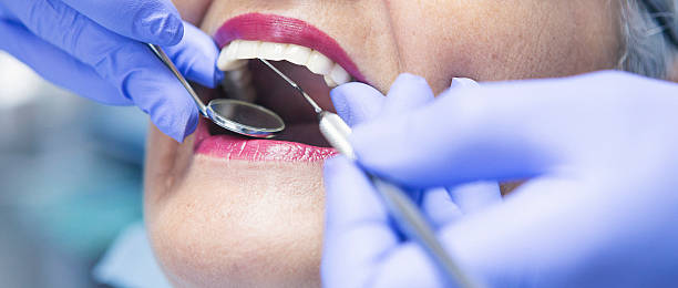 Best Dentist for Tooth Abscess  in Schulenburg, TX